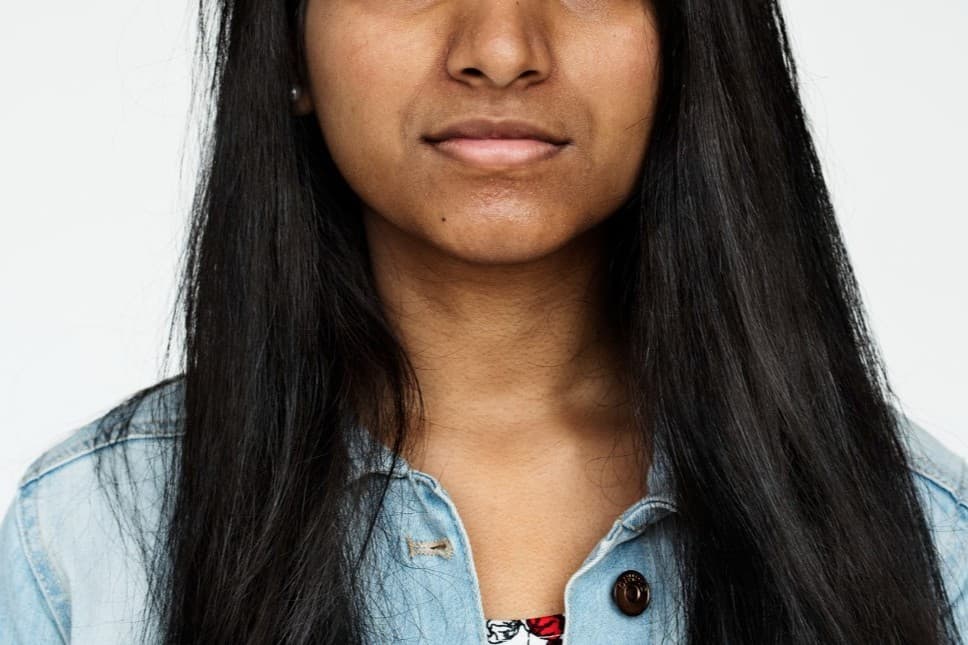 Hilangkan Kulit Gelap di Sekitar Mulut dengan 5 Pengobatan Alami Ini, Apa Saja? - Image