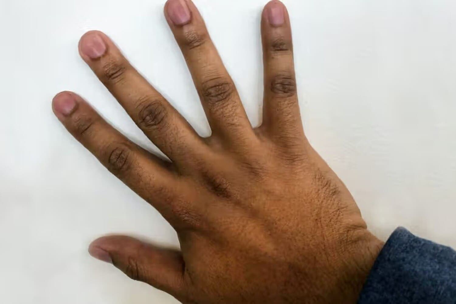 7 Cara Mencerahkan Buku-buku Jari Tangan yang Gelap Secara Alami di Rumah - Image