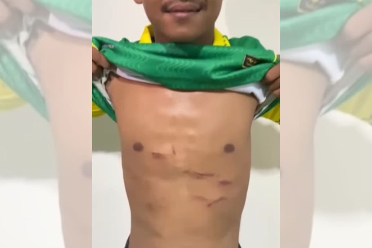 Tulang Rusuk Firman Nugraha Retak Gara-gara Tendangan Kung Fu Muhammad Hilmi! Terancam Absen 3 Bulan - Image