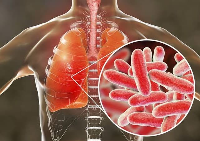 Memutus Rantai Genetik Thalasemia dengan kenali Ciri dan Penyebabnya - Image